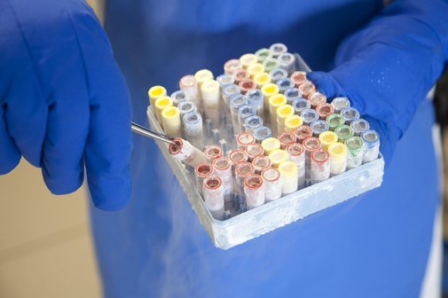 Symbolfoto: Stammzellverarbeitung im Krankenhaus. Nach der Stammzellentnahme und Aufarbeitung werden die Stammzellen computergesteuert eingefroren und in Stickstoff bei -160¡C gelagert.